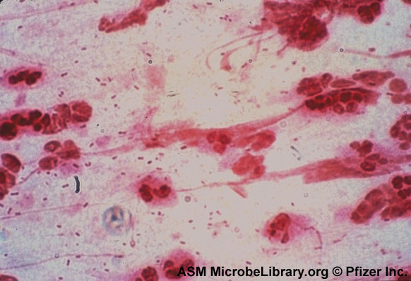 MHMC EVE/NITE SHIFT MICROBIOLOGY COMPETENCY ProProfs Quiz