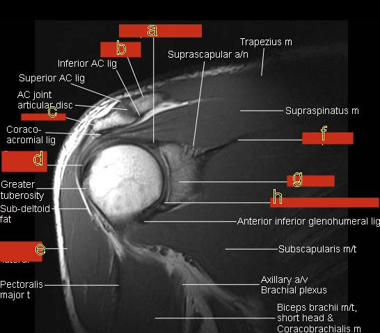 MRI Anatomy And Imaging - ProProfs Quiz