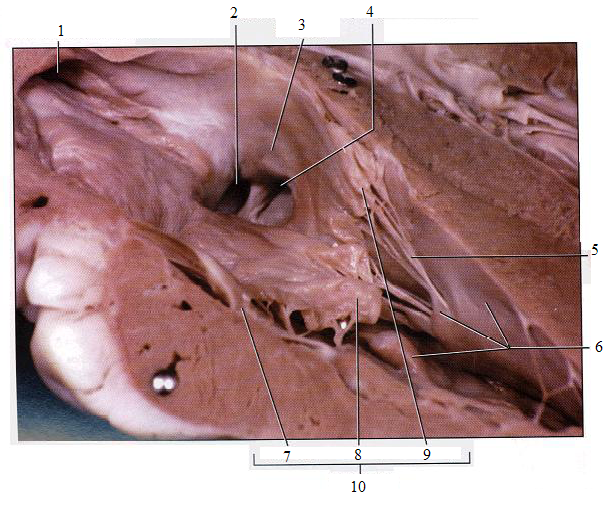 human heart diagram with labels. +heart+dissection+diagram