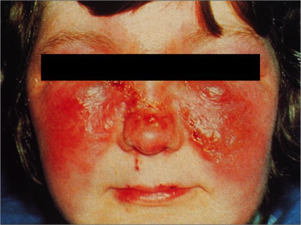 Infections Of The Skin - ProProfs Quiz