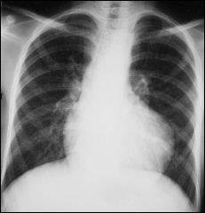 X-ray Related Medical Term Questions - Quiz