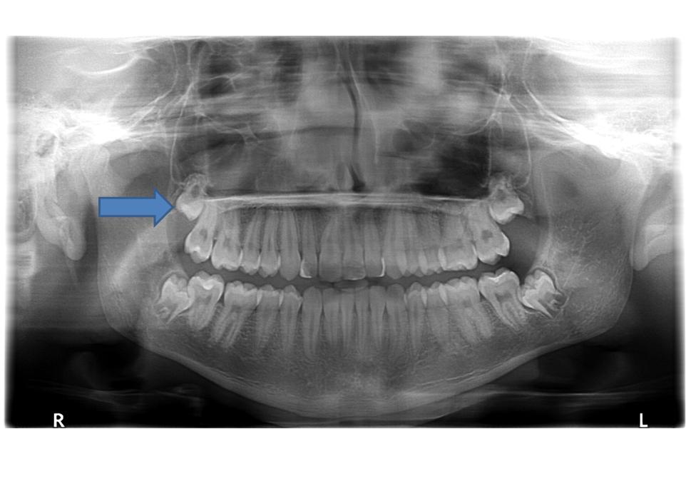 Dentistry/Dental AST. Simulation Examination 8 - Quiz & Trivia