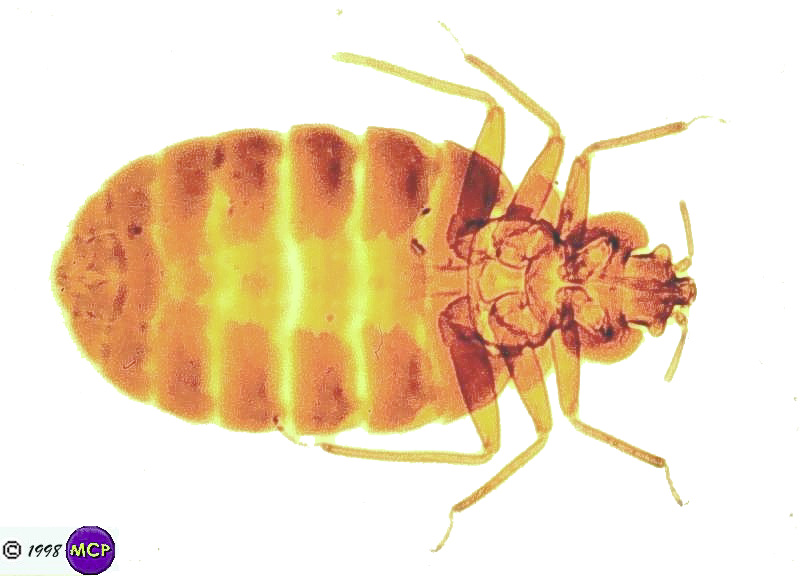 Vectors - Mites, Ticks, Lice And Fleas