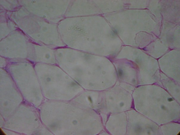 Microscopic Images of Tissues Flashcards - Flashcards