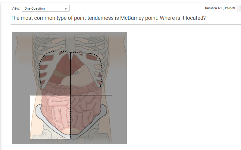 ProProfs Quiz Maker Hospot Area Question