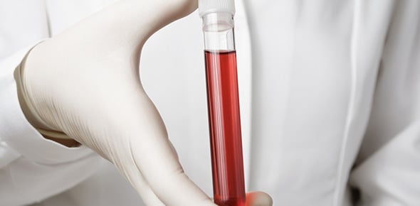 Mini Quiz Review- Blood Composition