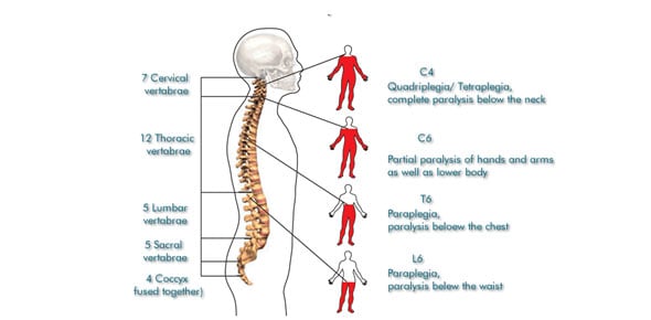 Spinal Cord Injury Quizzes & Trivia