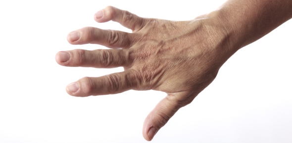 Osteoarthritis, Rheumatoid Arthritis And Other Types