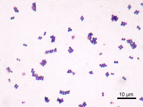 Take The Ultimate Microbiology Quiz Questions! ProProfs Quiz