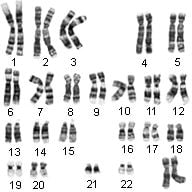 Ch. 12 Chromosomes And Human Inheritance Test Quiz