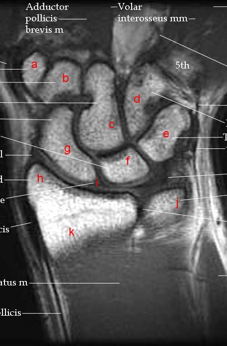 MRI Anatomy And Imaging - ProProfs Quiz