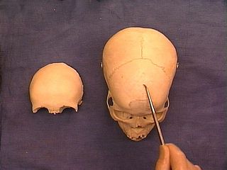 Lab Practical Quiz - Quiz