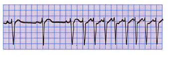 Medicine: CVS Exam Quiz!