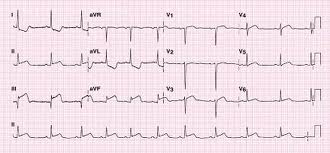 The EKG Quiz - Medical Science Test