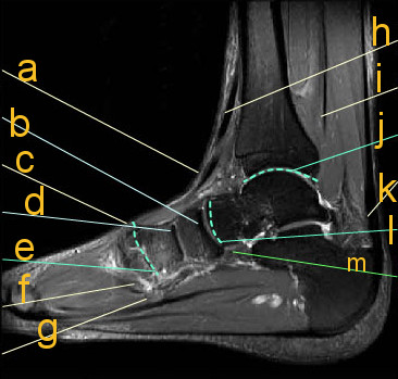 MRI Anatomy And Imaging