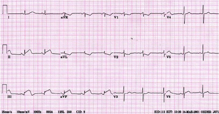 ECG Skills Trainer, Part I