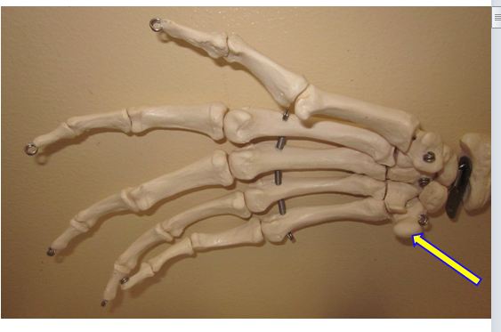 P-DAT 9 Hand And Upper Limb Joints - Quiz