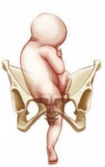 fetal presentation quiz
