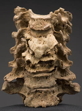 Biological Profiling Of The Human Skeleton