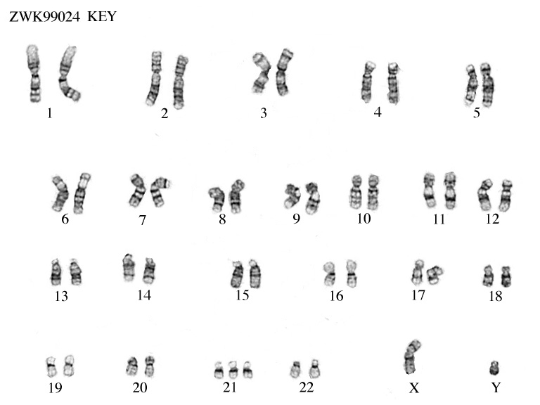 Karyotype Chart