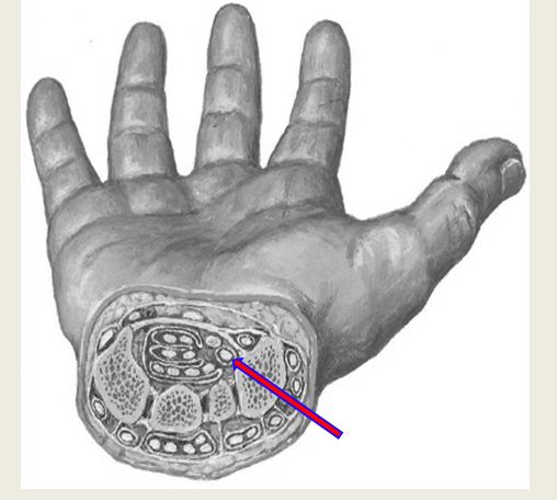 Hand foot and mouth disease