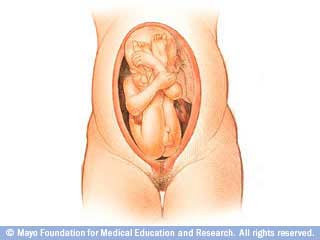 fetal presentation quiz
